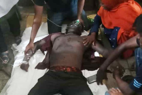 মেহেরপুরে বিদ্যুৎস্পৃষ্ট হয়ে নির্মাণ শ্রমিক আহত