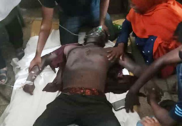 মেহেরপুরে বিদ্যুৎস্পৃষ্ট হয়ে নির্মাণ শ্রমিক আহত