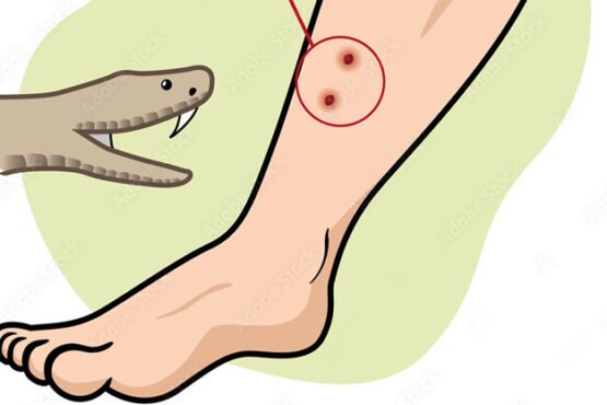 ভোলাহাটে সাপের কামড়ে একই দিনে ২ জনের মৃত্যু